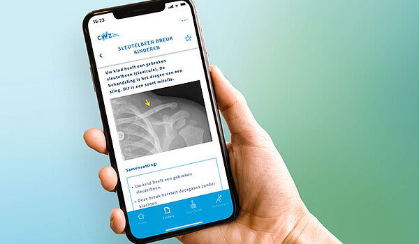 Virtual Fracture care app | CWZ Nijmegen