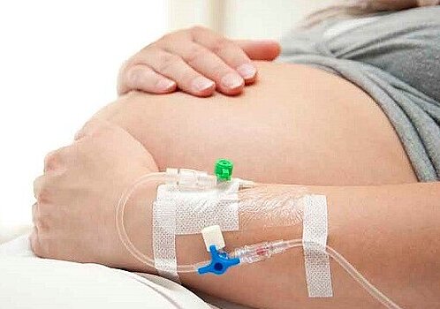 Thuisinfuus zwangerschapsbraken | CWZ Nijmegen