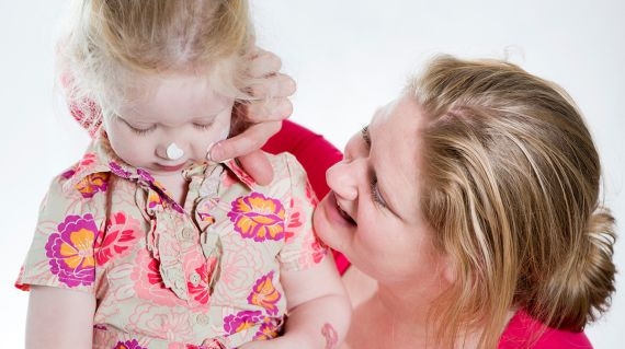 Moeder smeert dochter in tegen zonnebrand | CWZ Nijmegen
