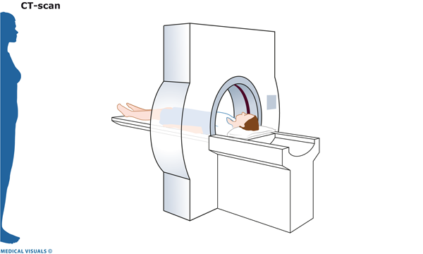 CT-scan | CWZ Nijmegen